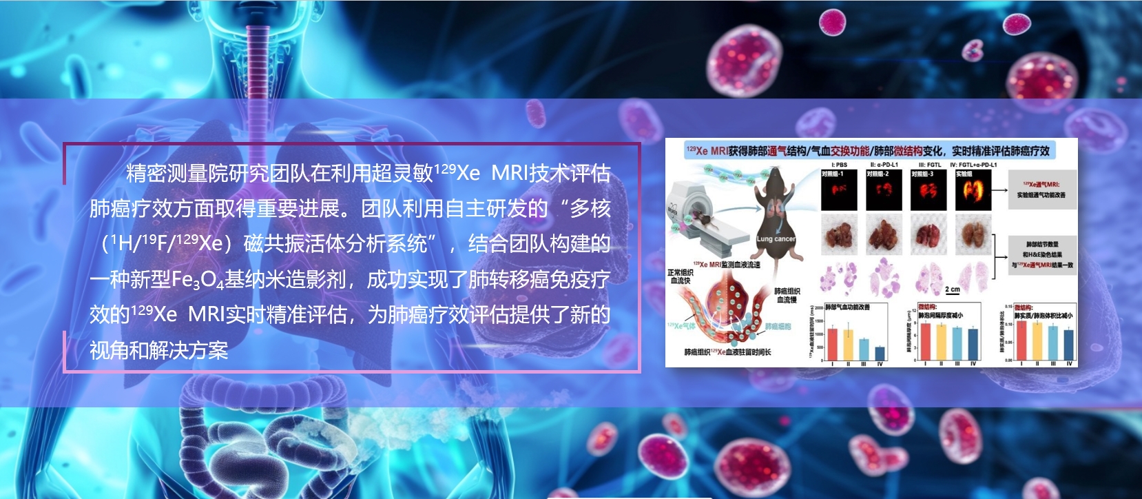 精密測量院在利用超靈敏<sup>129</sup>Xe MRI技術(shù)評估肺癌療效方面取得重要進(jìn)展
